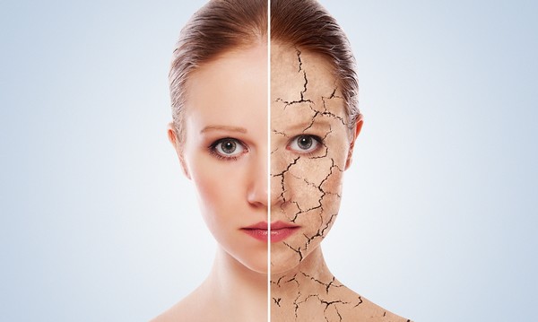 Winter Skin Care Tips 01 Taking Care Skin During the Winter