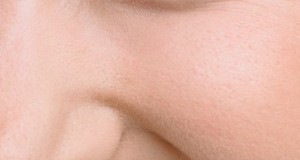 Treatment and Prevention For The Ages Spots