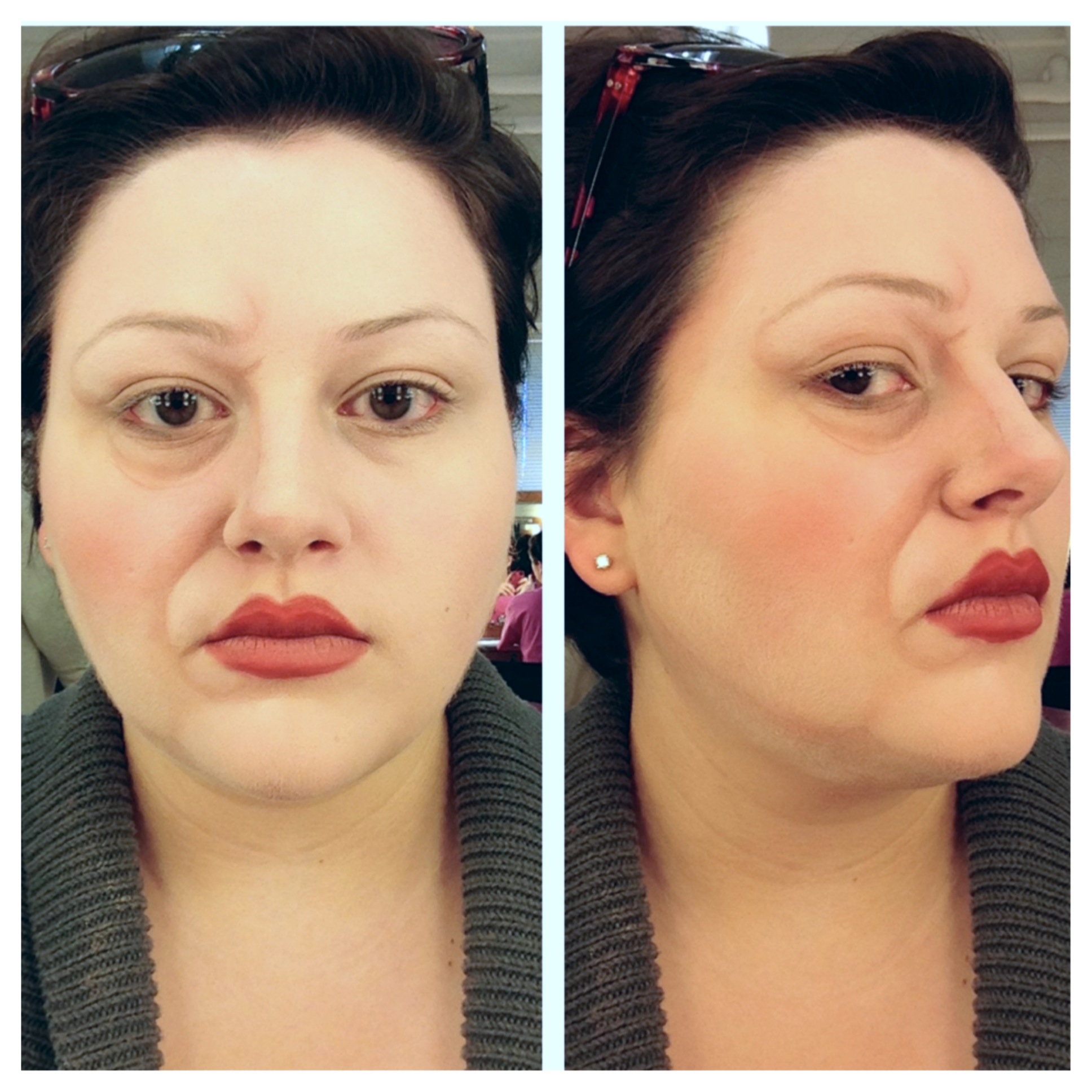 www.eventsstyle.com 40070 The fattening of face components from your kitchen